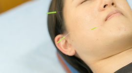 舌痛症・口腔内灼熱症候群