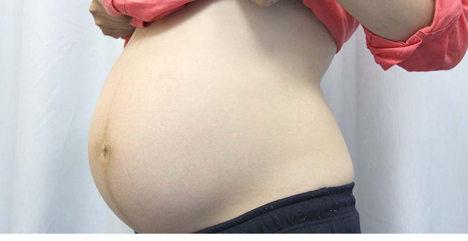 陣痛が来ない時の鍼灸治療