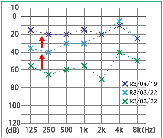 めまい・メニエール病・PPPD