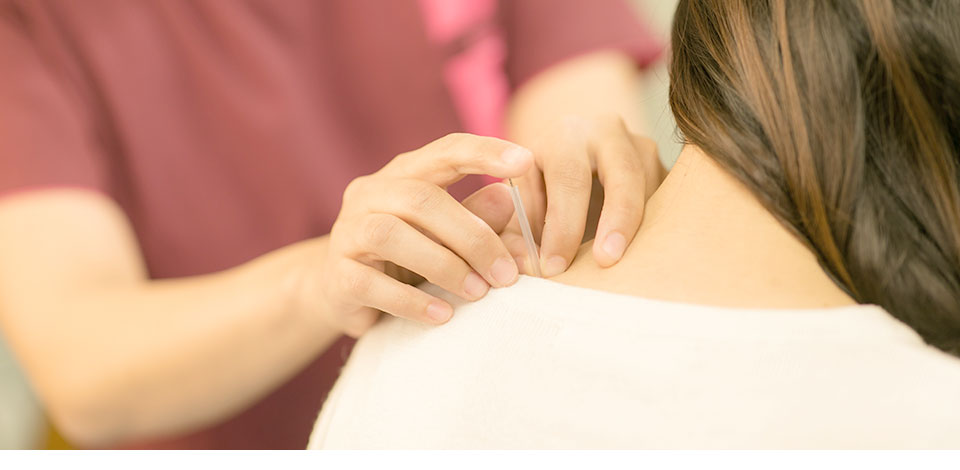 慢性的な肩こりに対する鍼灸治療