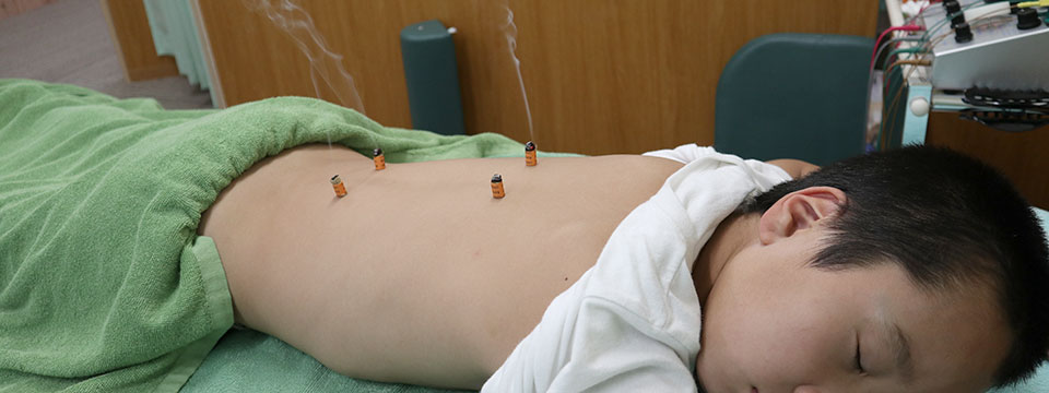 起立性調節障害に対する鍼灸治療