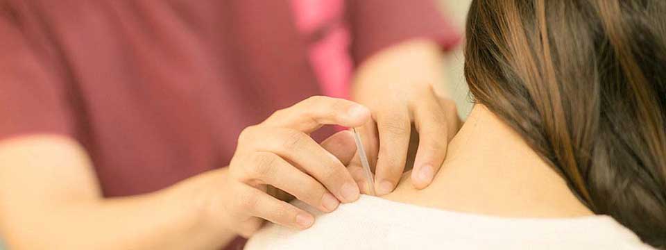 薄毛に対する鍼灸治療