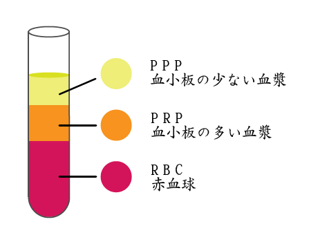 膝の再生医療PRP療法と鍼灸